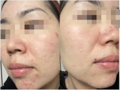 告别敏感肌的困扰！蓓肌安朵态舒缓修护霜让妈妈漂亮“美”一天